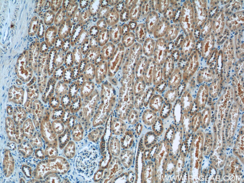 Immunohistochemistry (IHC) staining of human kidney tissue using SMU1 Polyclonal antibody (15511-1-AP)