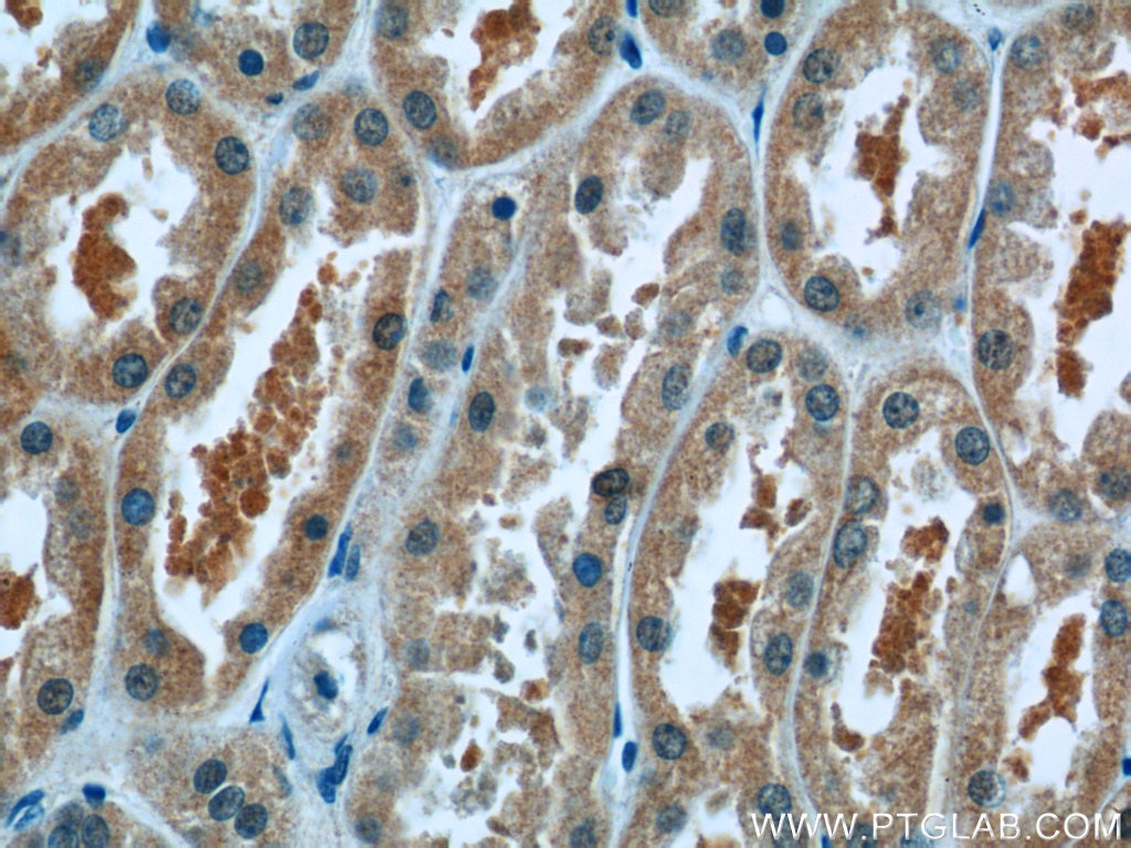 Immunohistochemistry (IHC) staining of human kidney tissue using SMU1 Polyclonal antibody (15511-1-AP)