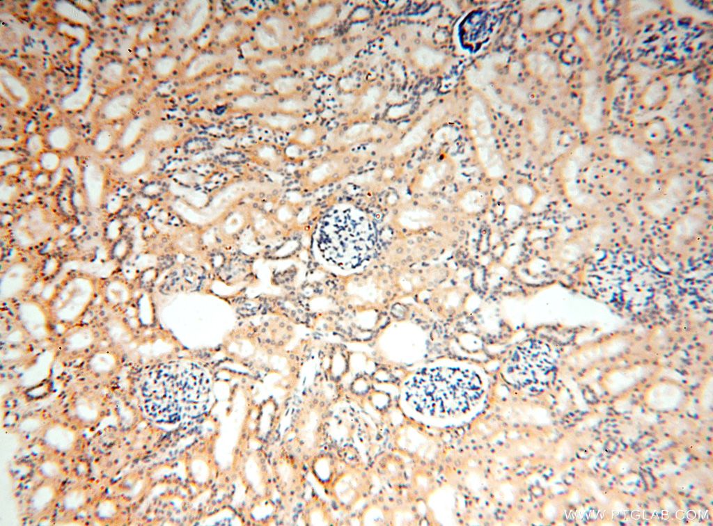 Immunohistochemistry (IHC) staining of human kidney tissue using SMU1 Polyclonal antibody (15511-1-AP)