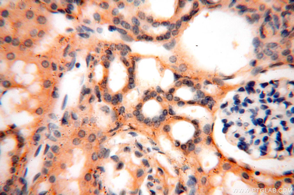 Immunohistochemistry (IHC) staining of human kidney tissue using SMU1 Polyclonal antibody (15511-1-AP)