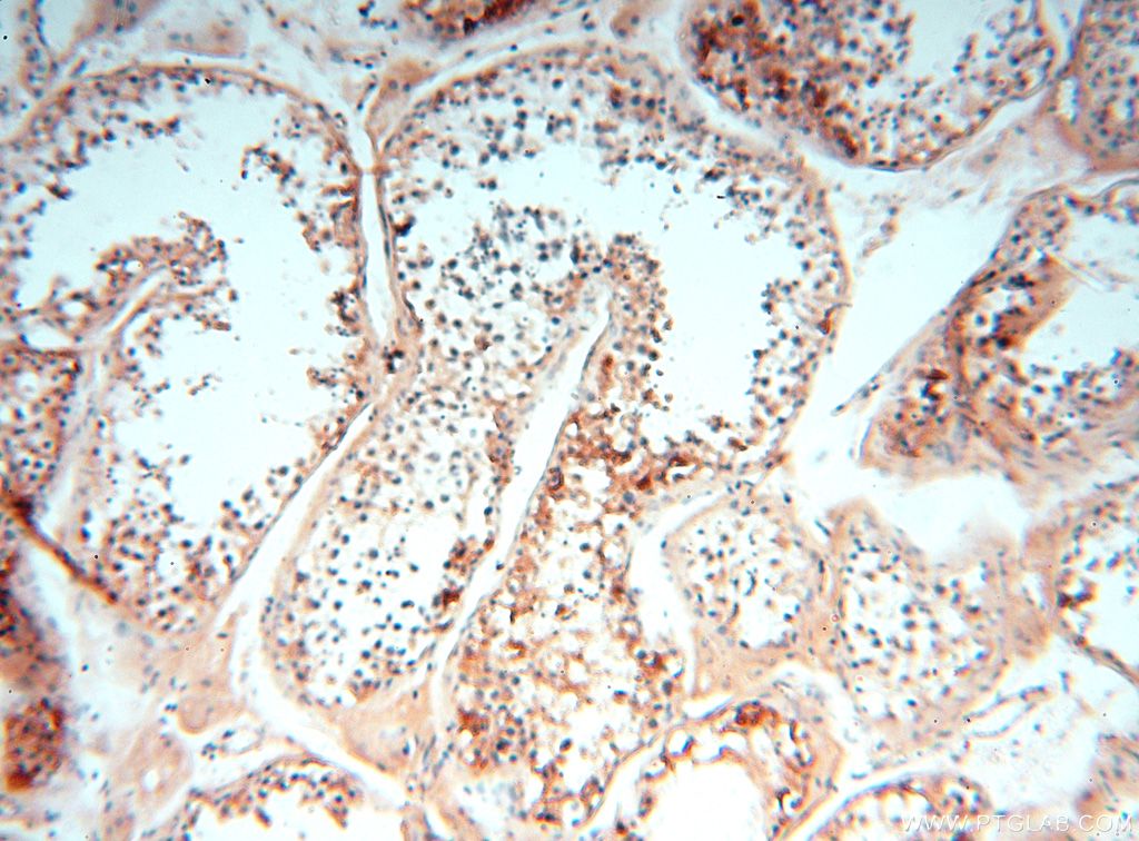 Immunohistochemistry (IHC) staining of human testis tissue using SMU1 Polyclonal antibody (15511-1-AP)