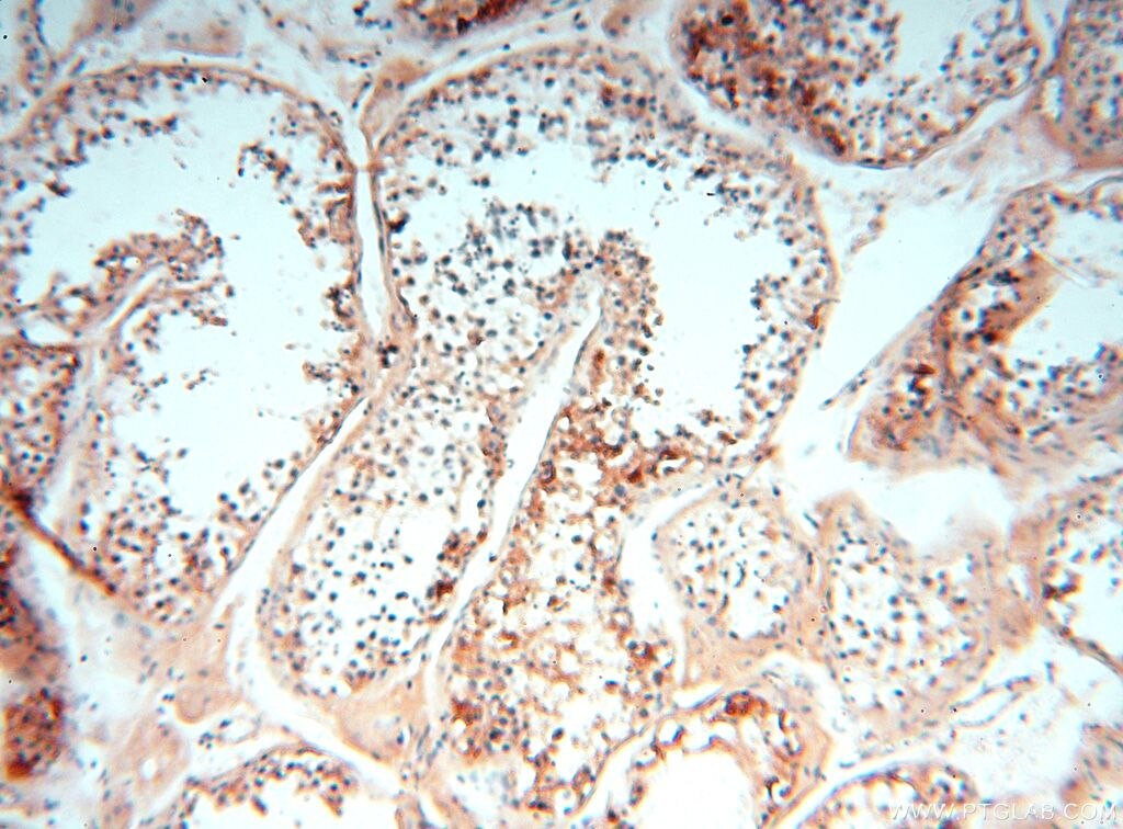 IHC staining of human testis using 15511-1-AP