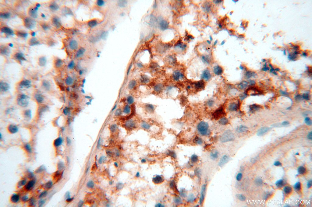 Immunohistochemistry (IHC) staining of human testis tissue using SMU1 Polyclonal antibody (15511-1-AP)