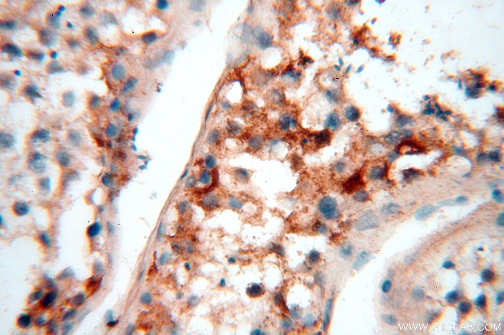 IHC staining of human testis using 15511-1-AP