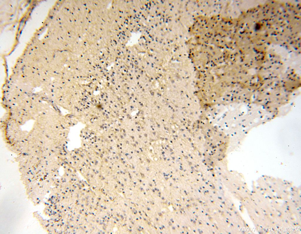 Immunohistochemistry (IHC) staining of human brain tissue using SMU1 Polyclonal antibody (15511-1-AP)