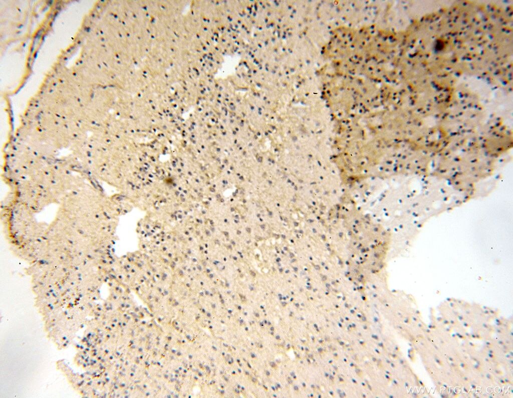 Immunohistochemistry (IHC) staining of human brain tissue using SMU1 Polyclonal antibody (15511-1-AP)