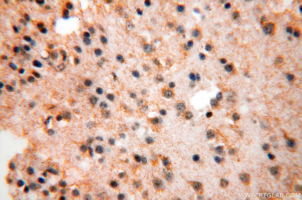 Immunohistochemistry (IHC) staining of human brain tissue using SMU1 Polyclonal antibody (15511-1-AP)