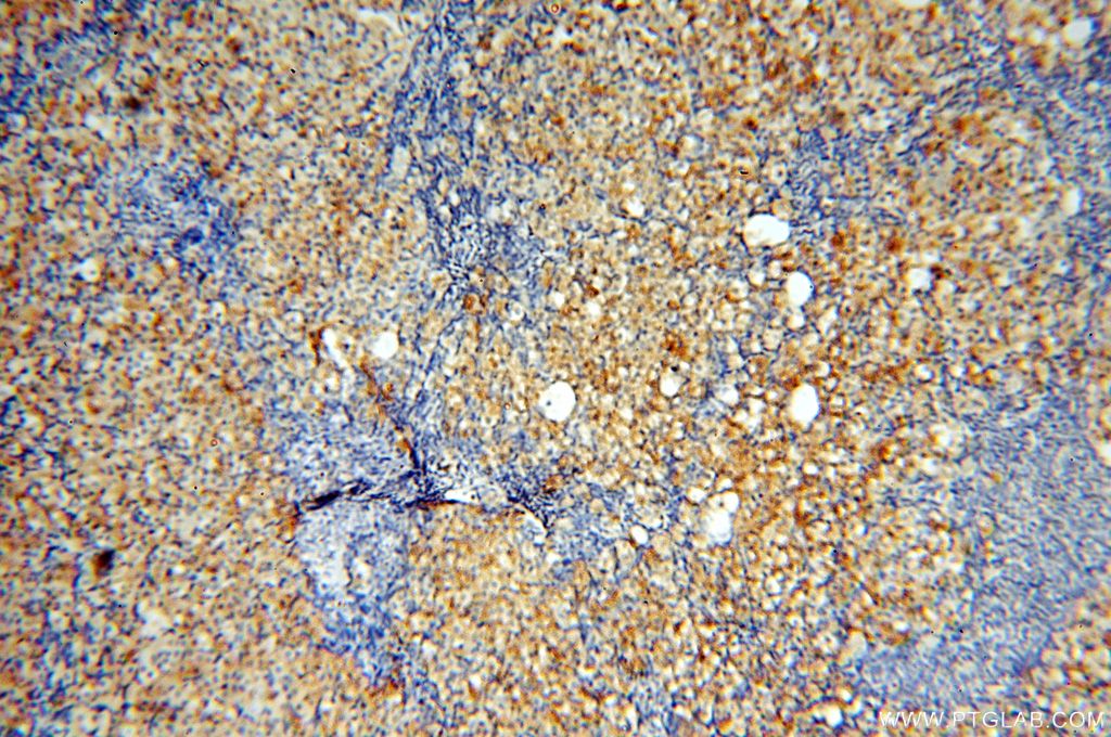 Immunohistochemistry (IHC) staining of human ovary tissue using SMU1 Polyclonal antibody (15511-1-AP)