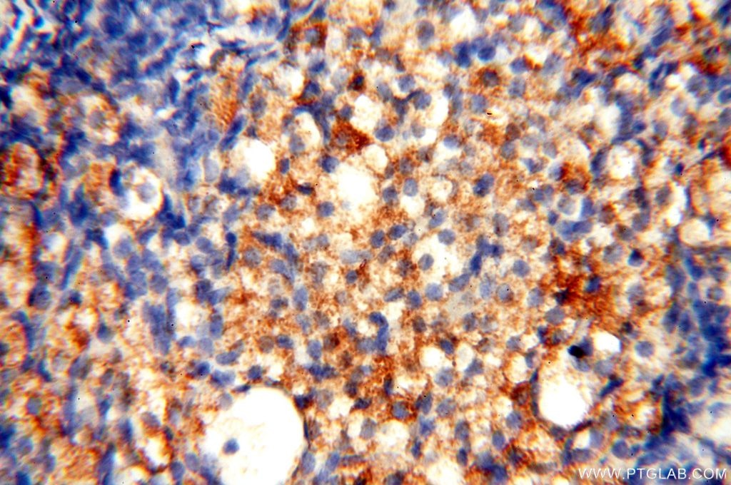 Immunohistochemistry (IHC) staining of human ovary tissue using SMU1 Polyclonal antibody (15511-1-AP)