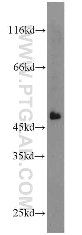 Western Blot (WB) analysis of mouse liver tissue using SMU1 Polyclonal antibody (15511-1-AP)