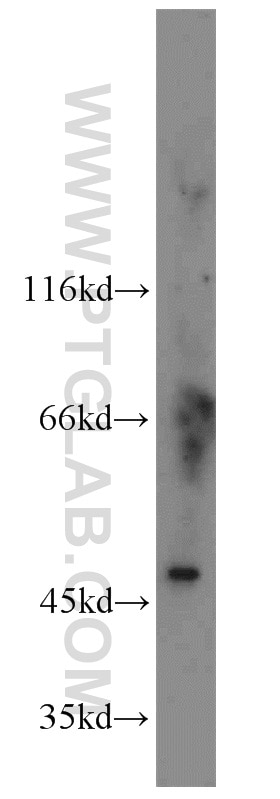 Western Blot (WB) analysis of K-562 cells using SMU1 Polyclonal antibody (15511-1-AP)