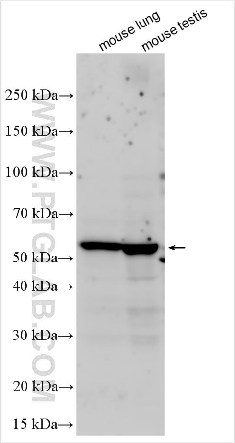 WB analysis using 33253-1-AP Western Blot (WB) analysis of various lysates using SMU1 Polyclonal antibody (33253-1-AP)