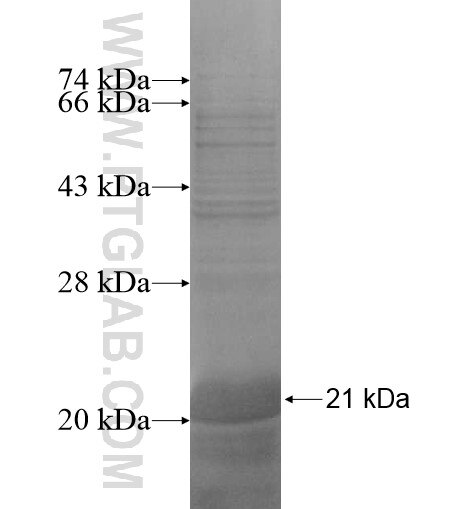 SMUG1 fusion protein Ag13982 SDS-PAGE