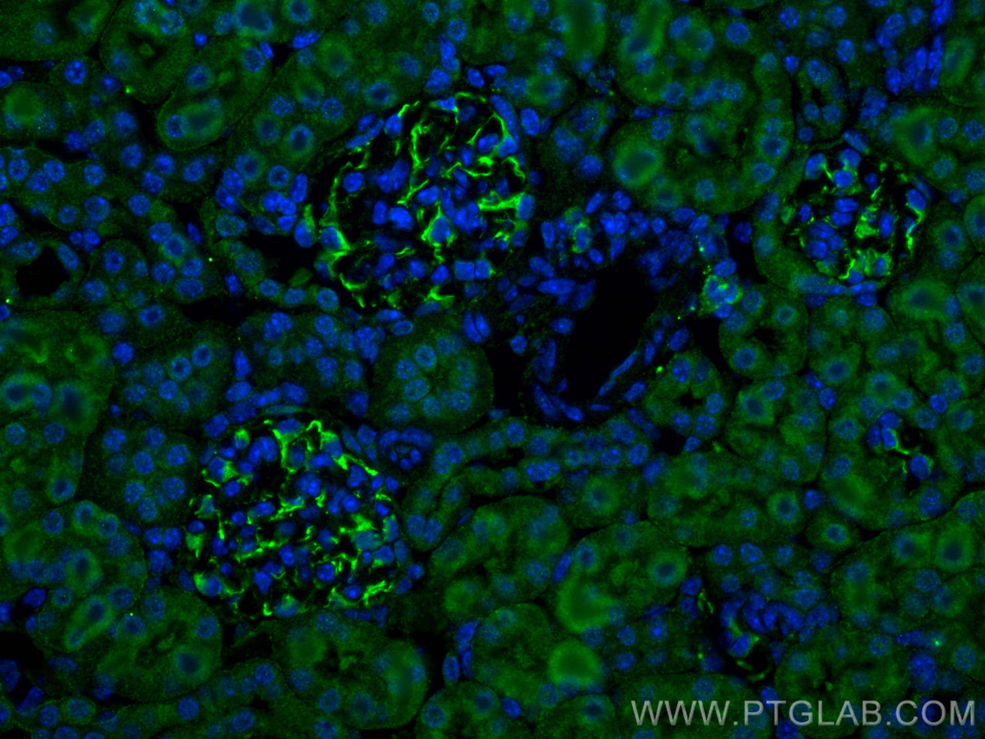 Immunofluorescence (IF) / fluorescent staining of mouse kidney tissue using SMURF1 Polyclonal antibody (55175-1-AP)