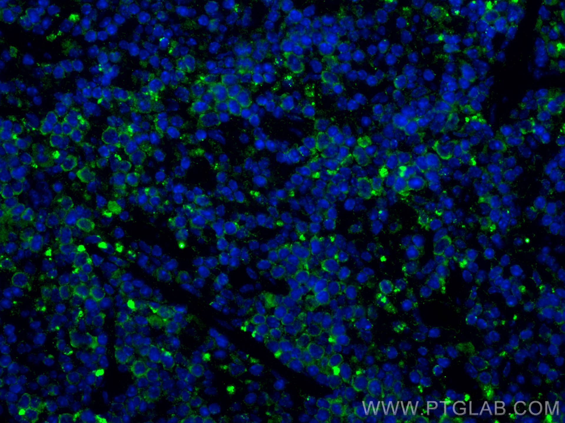 Immunofluorescence (IF) / fluorescent staining of mouse spleen tissue using SMURF1 Polyclonal antibody (55175-1-AP)