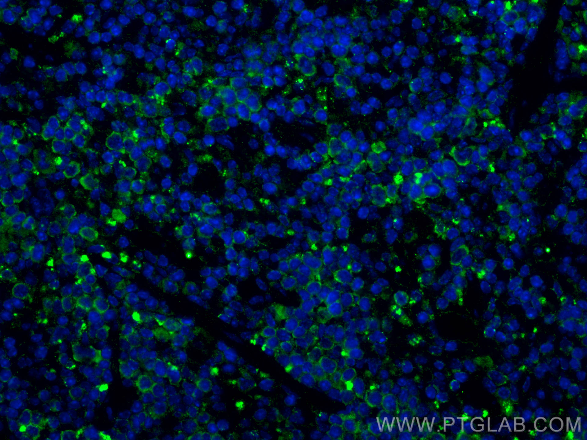 IF Staining of mouse spleen using 55175-1-AP