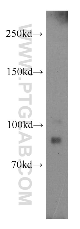 Western Blot (WB) analysis of HepG2 cells using SMURF1 Polyclonal antibody (55175-1-AP)