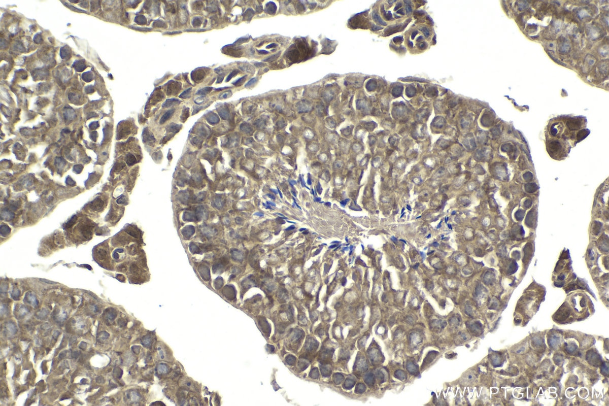 Immunohistochemistry (IHC) staining of mouse testis tissue using SMURF2 Polyclonal antibody (18038-1-AP)