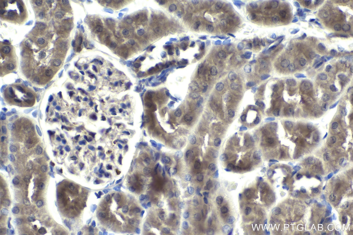 Immunohistochemistry (IHC) staining of rat kidney tissue using SMURF2 Polyclonal antibody (18038-1-AP)
