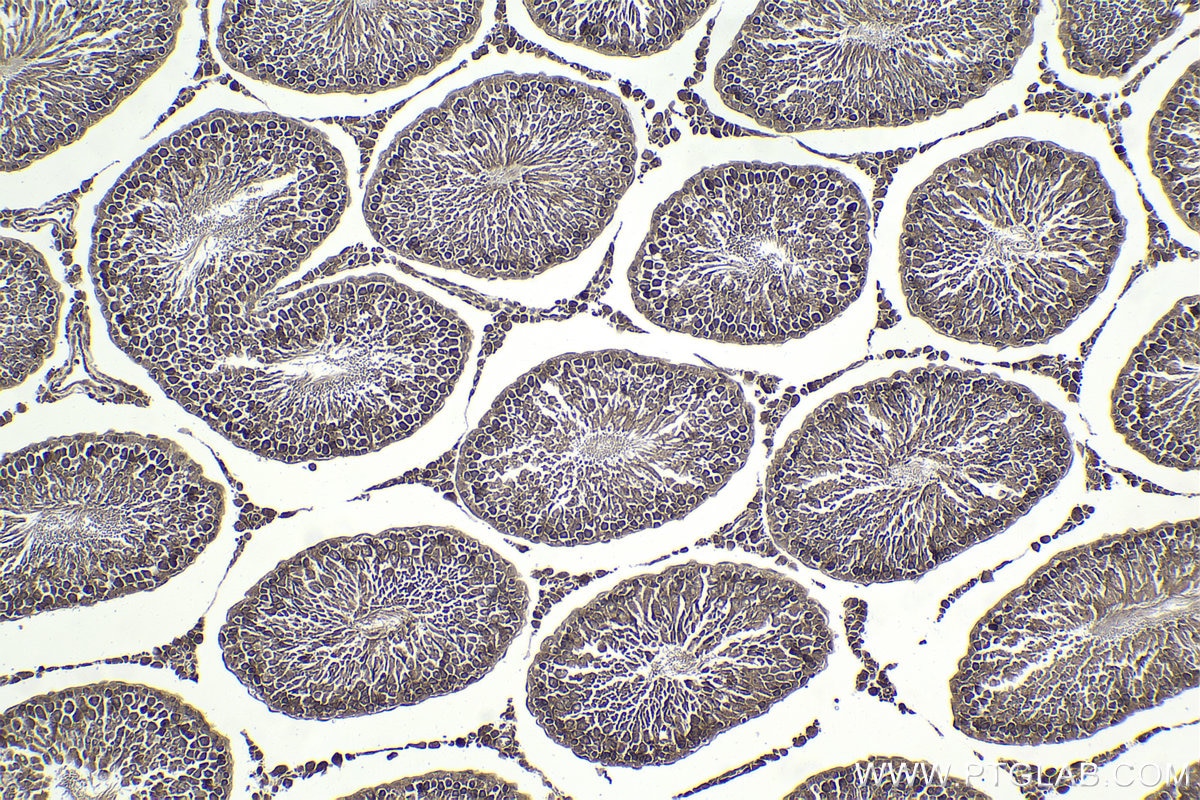 Immunohistochemistry (IHC) staining of rat testis tissue using SMURF2 Polyclonal antibody (18038-1-AP)