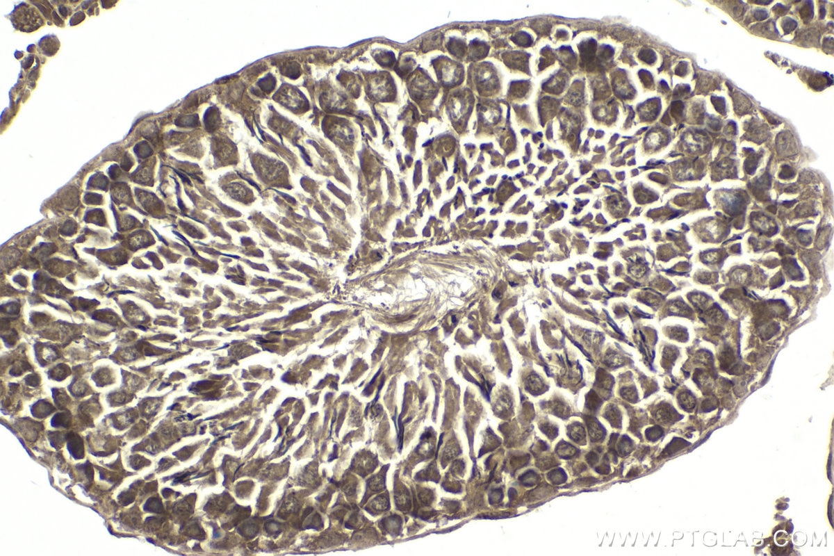 Immunohistochemistry (IHC) staining of rat testis tissue using SMURF2 Polyclonal antibody (18038-1-AP)