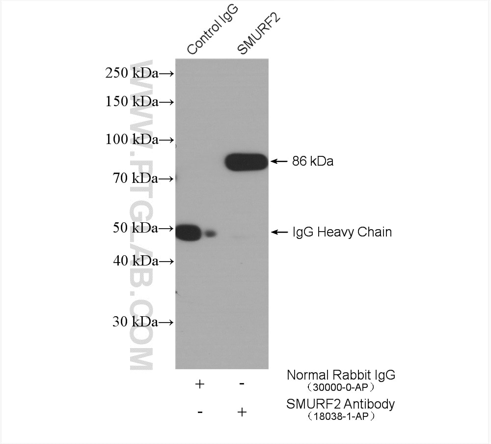 Immunoprecipitation (IP) experiment of mouse testis tissue using SMURF2 Polyclonal antibody (18038-1-AP)