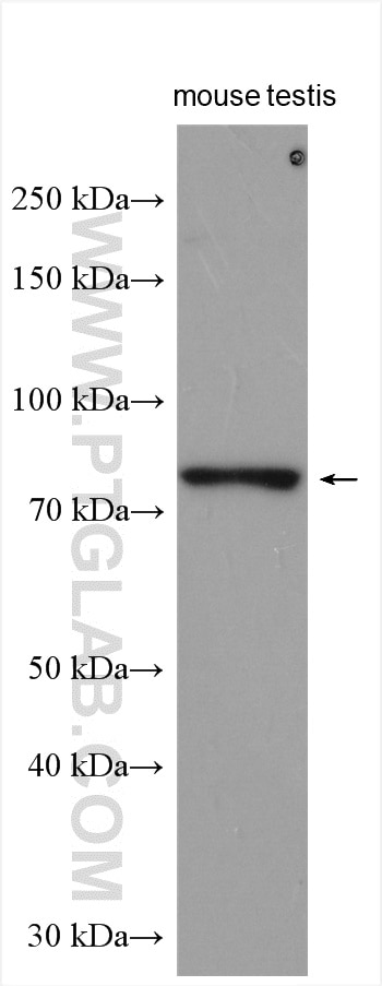 Western Blot (WB) analysis of various lysates using SMURF2 Polyclonal antibody (18038-1-AP)