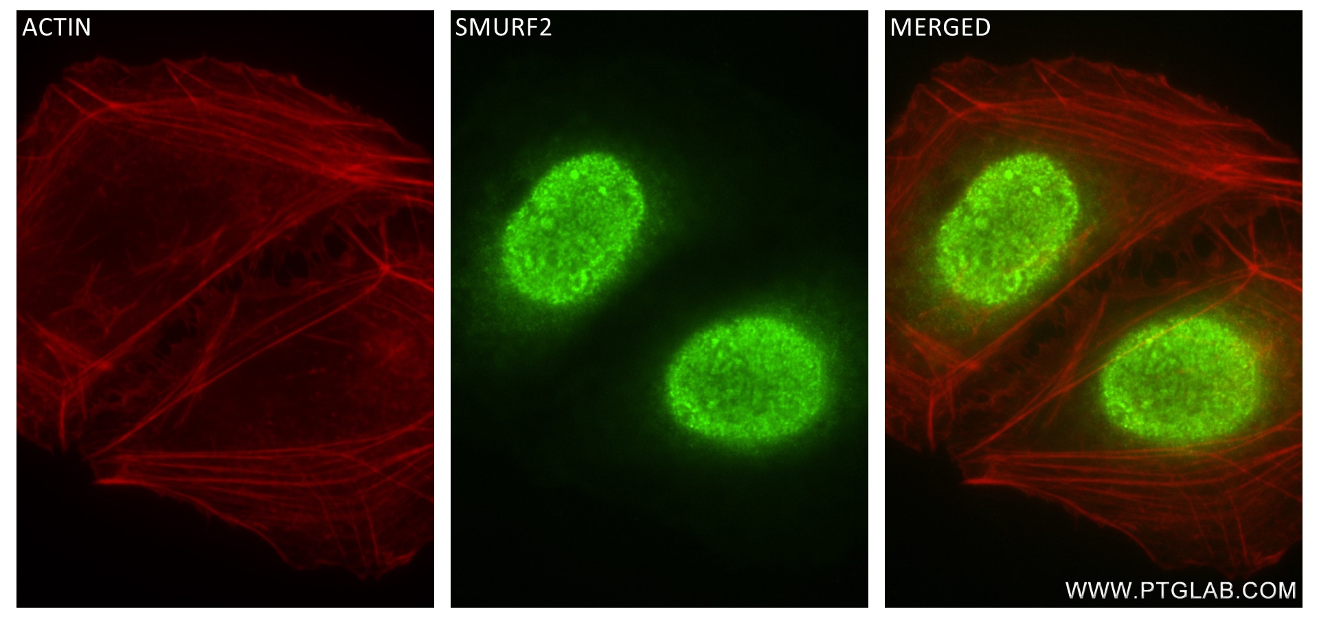 Immunofluorescence (IF) / fluorescent staining of U2OS cells using SMURF2 Recombinant antibody (84445-1-RR)
