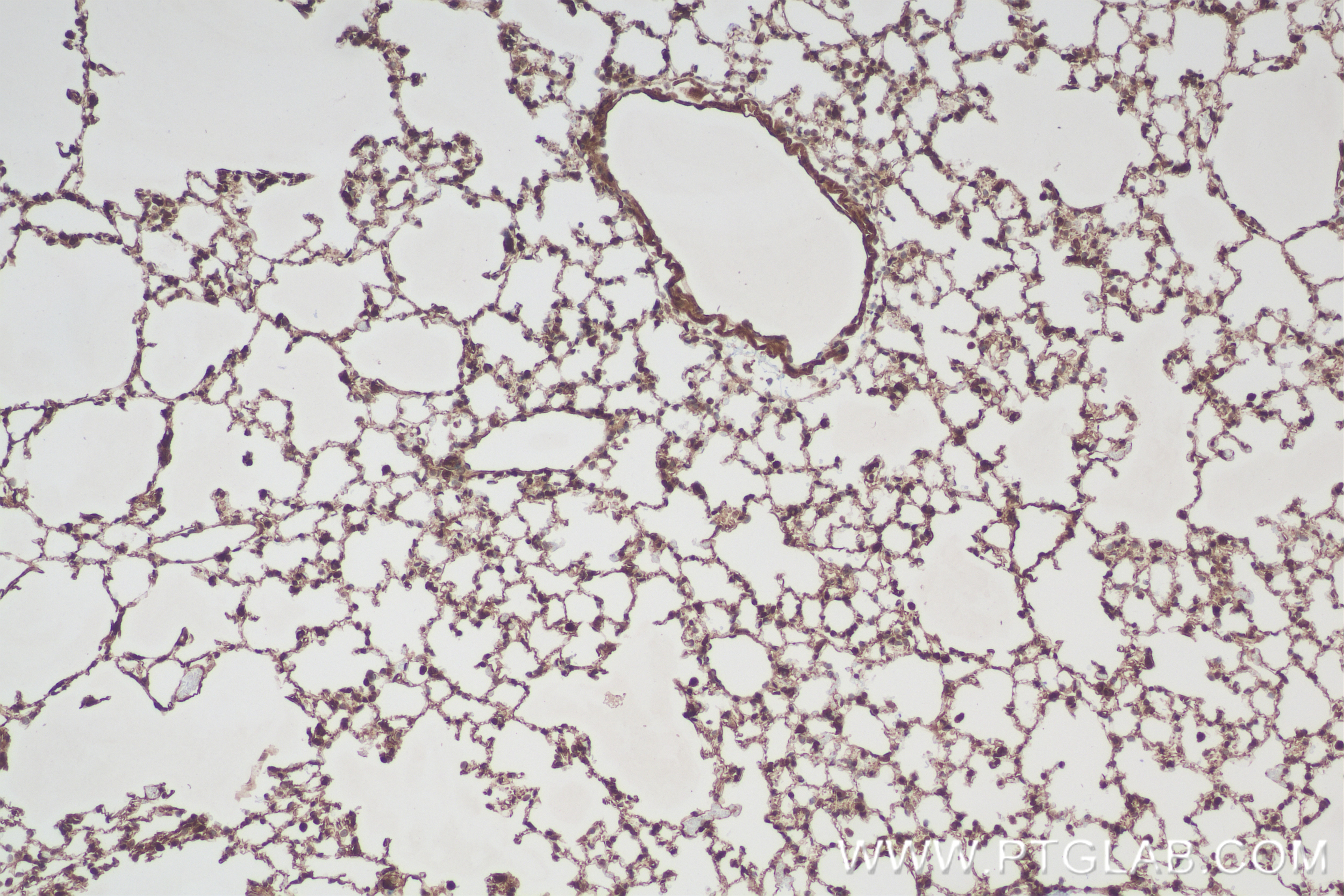 Immunohistochemistry (IHC) staining of mouse lung tissue using SMURF2 Recombinant antibody (84445-1-RR)