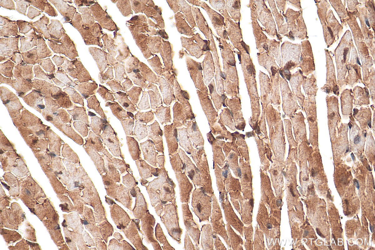 Immunohistochemistry (IHC) staining of mouse heart tissue using SMYD1-Specific Polyclonal antibody (16151-1-AP)