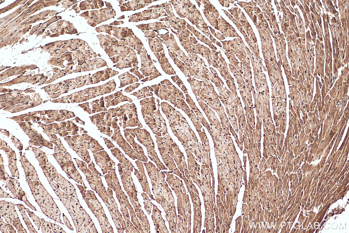 Immunohistochemistry (IHC) staining of mouse heart tissue using SMYD1-Specific Polyclonal antibody (16151-1-AP)