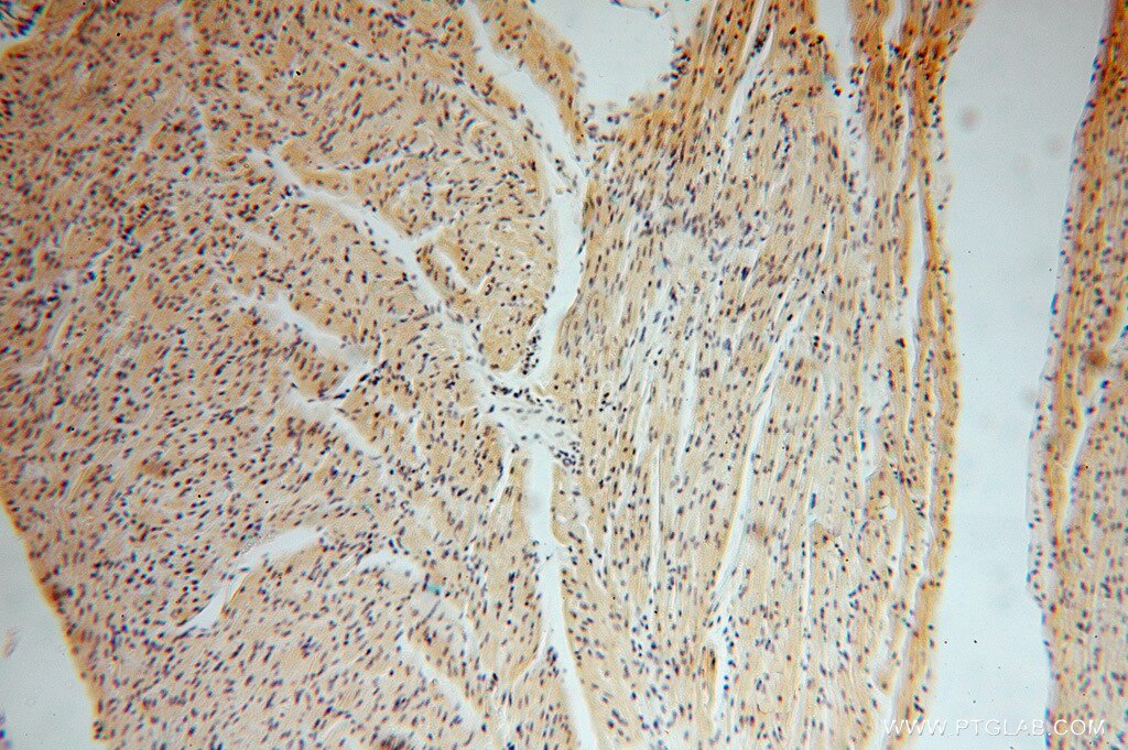 Immunohistochemistry (IHC) staining of human heart tissue using SMYD1-Specific Polyclonal antibody (16151-1-AP)