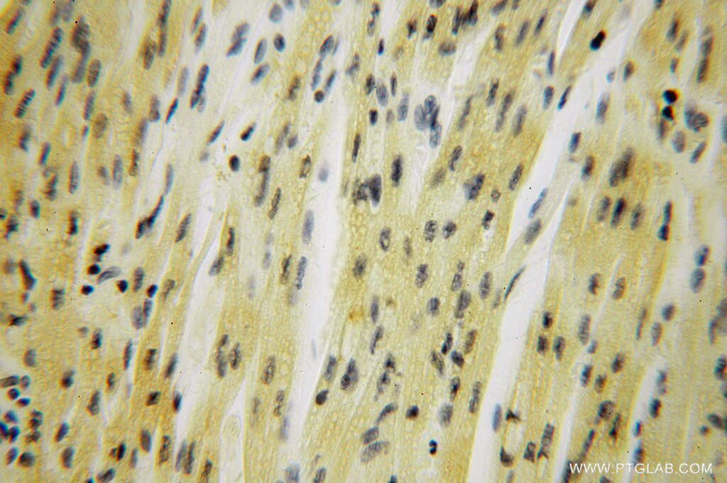 Immunohistochemistry (IHC) staining of human heart tissue using SMYD1-Specific Polyclonal antibody (16151-1-AP)