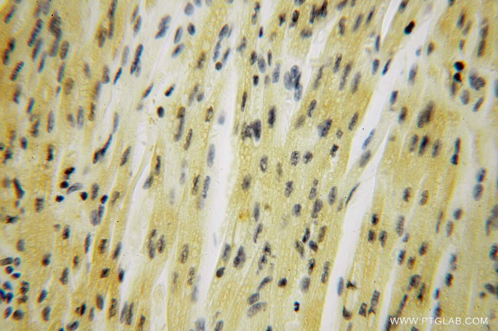 Immunohistochemistry (IHC) staining of human heart tissue using SMYD1-Specific Polyclonal antibody (16151-1-AP)