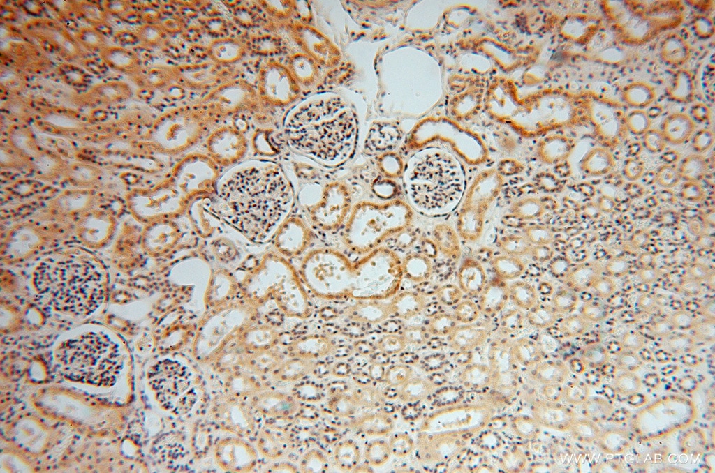Immunohistochemistry (IHC) staining of human kidney tissue using SMYD1-Specific Polyclonal antibody (16151-1-AP)
