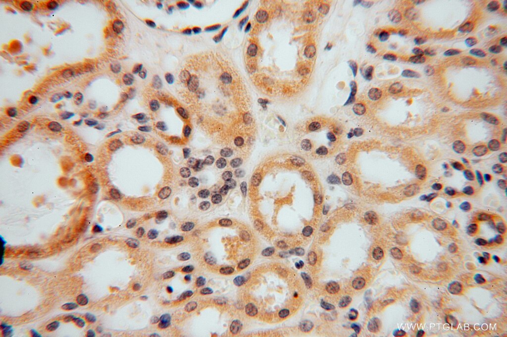 Immunohistochemistry (IHC) staining of human kidney tissue using SMYD1-Specific Polyclonal antibody (16151-1-AP)