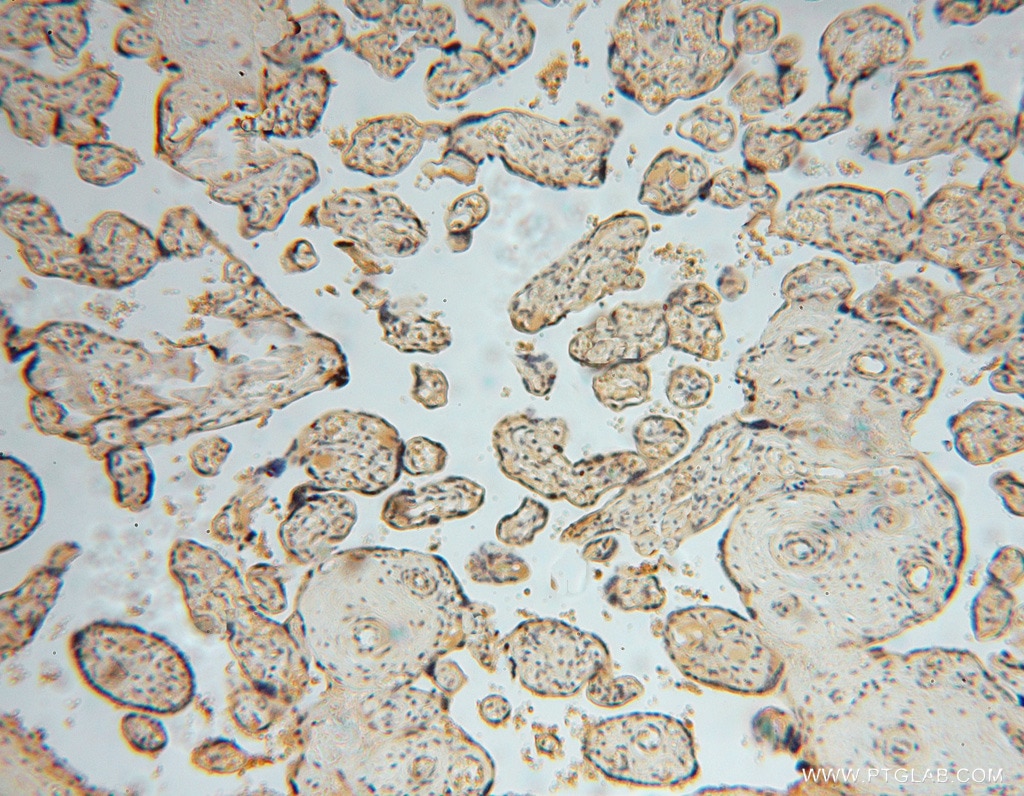 Immunohistochemistry (IHC) staining of human placenta tissue using SMYD1-Specific Polyclonal antibody (16151-1-AP)