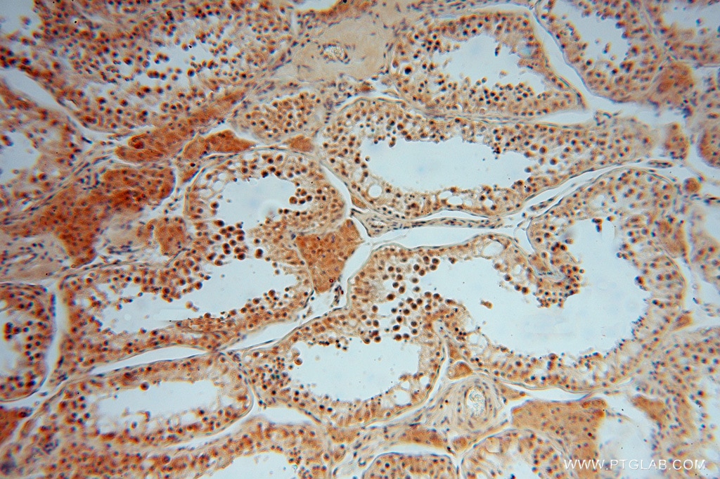 Immunohistochemistry (IHC) staining of human testis tissue using SMYD1-Specific Polyclonal antibody (16151-1-AP)