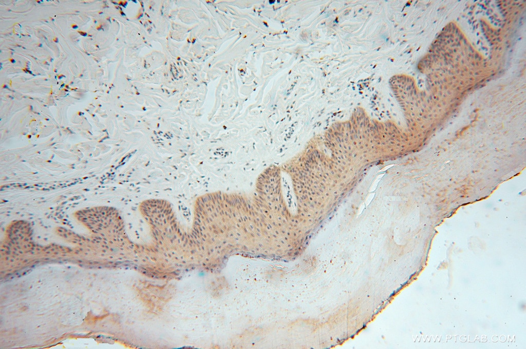 Immunohistochemistry (IHC) staining of human skin tissue using SMYD1-Specific Polyclonal antibody (16151-1-AP)