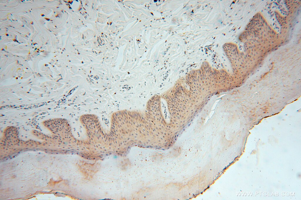 Immunohistochemistry (IHC) staining of human skin tissue using SMYD1-Specific Polyclonal antibody (16151-1-AP)