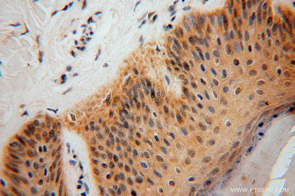 IHC staining of human skin using 16151-1-AP