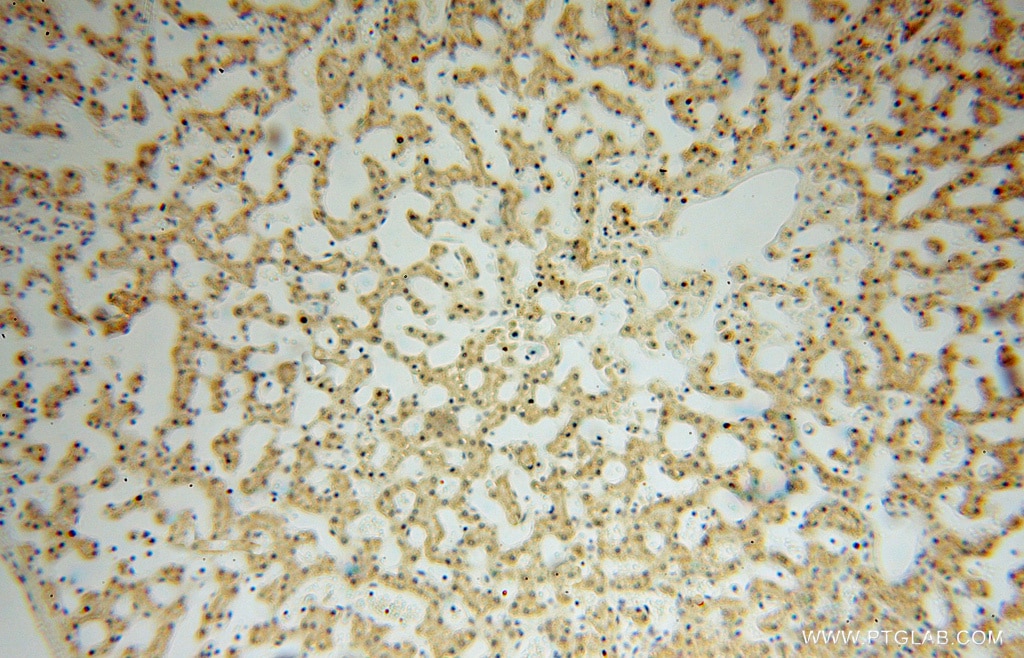 Immunohistochemistry (IHC) staining of human liver tissue using SMYD1-Specific Polyclonal antibody (16151-1-AP)