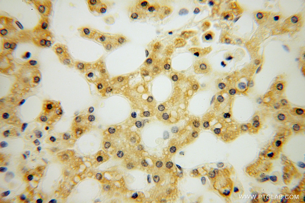 Immunohistochemistry (IHC) staining of human liver tissue using SMYD1-Specific Polyclonal antibody (16151-1-AP)