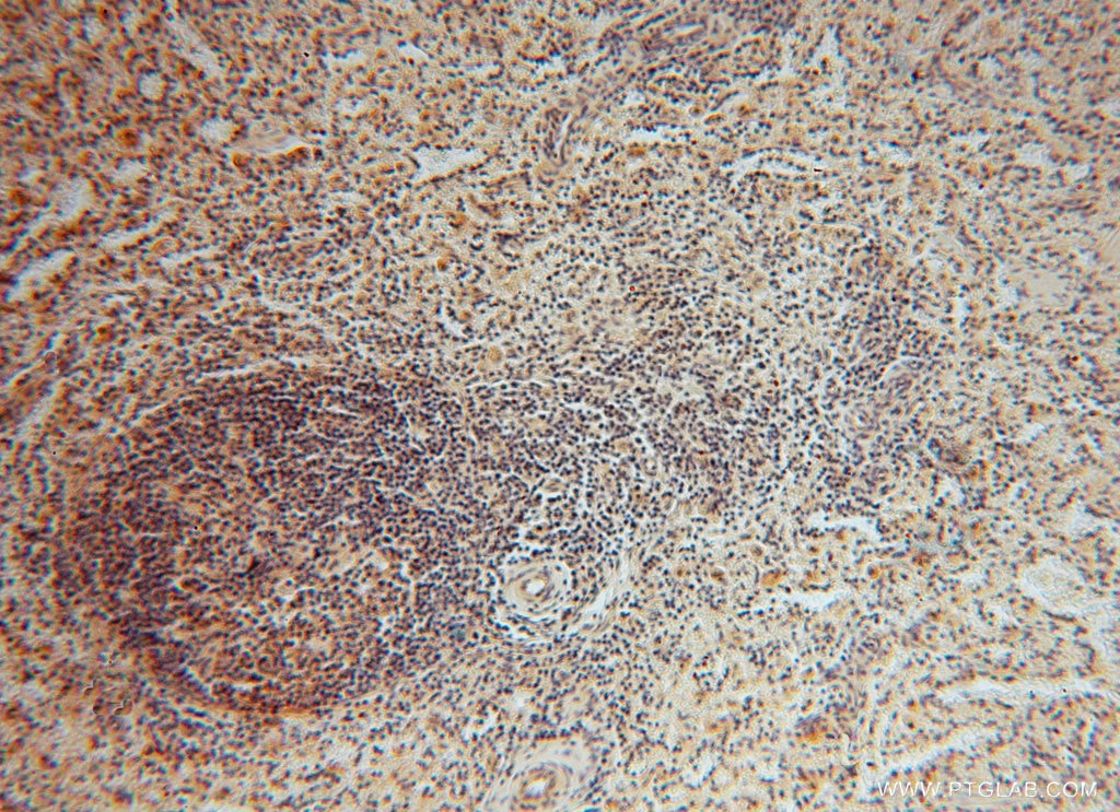 Immunohistochemistry (IHC) staining of human spleen tissue using SMYD1-Specific Polyclonal antibody (16151-1-AP)