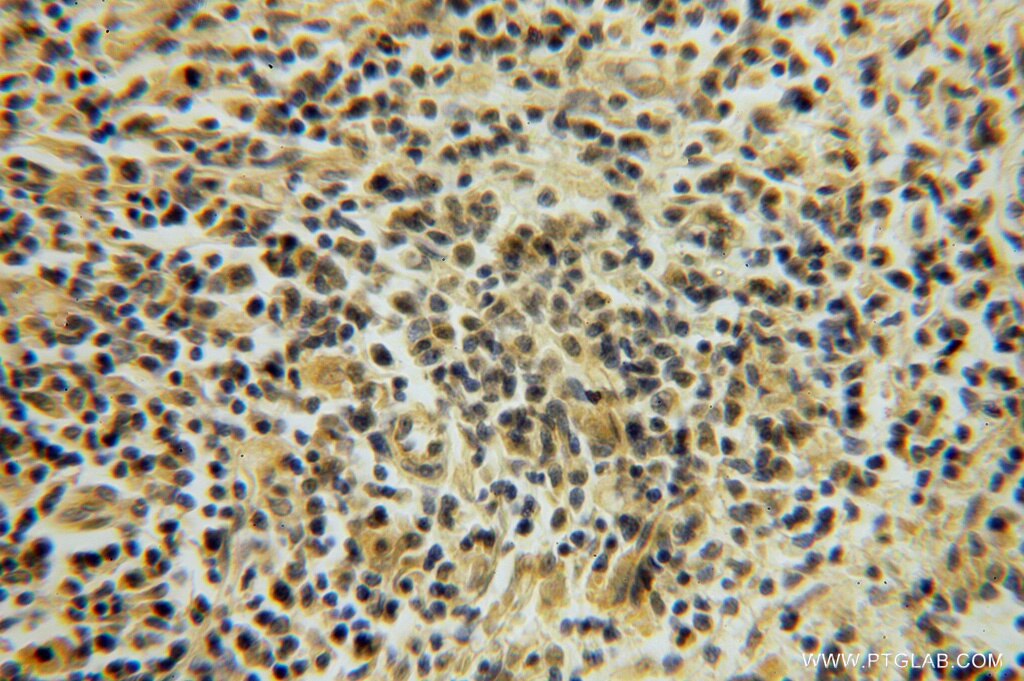 Immunohistochemistry (IHC) staining of human spleen tissue using SMYD1-Specific Polyclonal antibody (16151-1-AP)