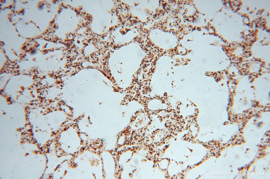 Immunohistochemistry (IHC) staining of human lung tissue using SMYD1-Specific Polyclonal antibody (16151-1-AP)