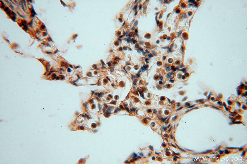 Immunohistochemistry (IHC) staining of human lung tissue using SMYD1-Specific Polyclonal antibody (16151-1-AP)