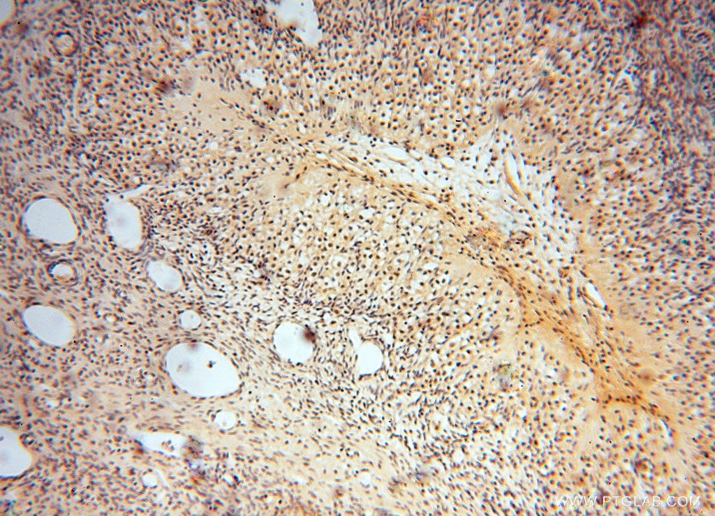 IHC staining of human ovary using 16151-1-AP