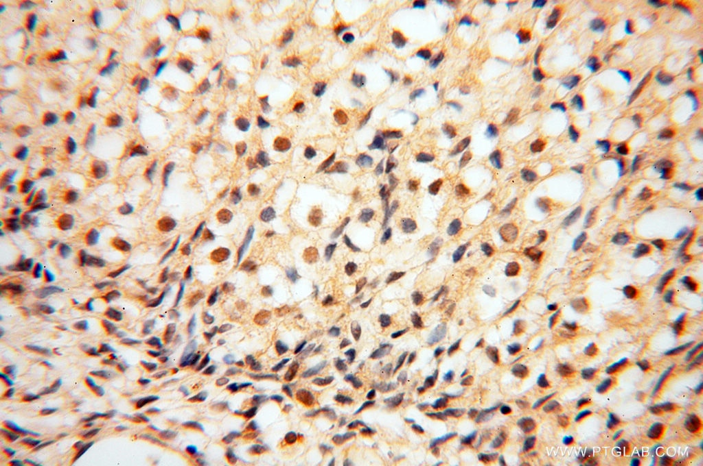 Immunohistochemistry (IHC) staining of human ovary tissue using SMYD1-Specific Polyclonal antibody (16151-1-AP)