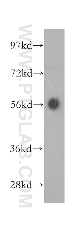 Western Blot (WB) analysis of mouse skeletal muscle tissue using SMYD1-Specific Polyclonal antibody (16151-1-AP)